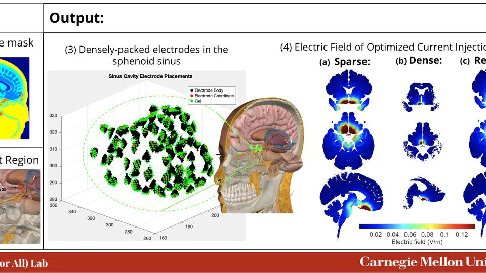 Optimized Transnasal Electrical Stimulation Using High-Density Electrode Arrangements